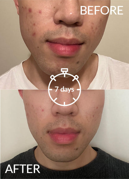 Skintelligence Purifying Serum