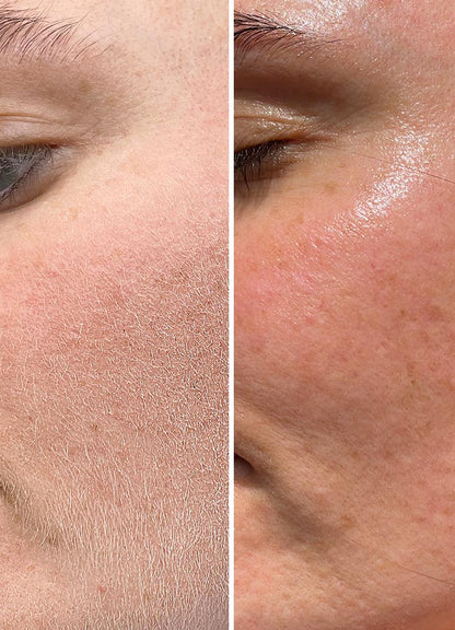 Brandluxe Dermaplaning Tool