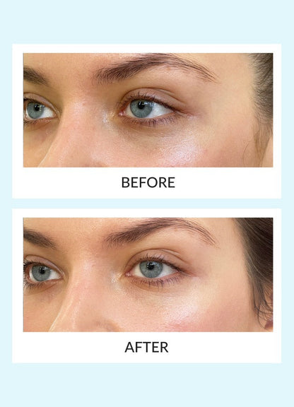 Reusable Eye Therapy Patches Solo